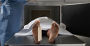 Escáneres podrían reducir el número de autopsias