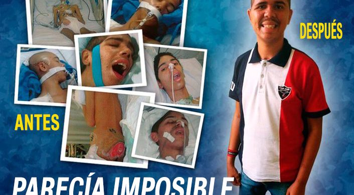 Parecía imposible sobrevivir